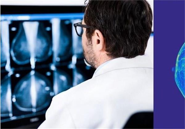 چرا مرگ‌ومیر سرطان پستان مهار نمی‌شود؟